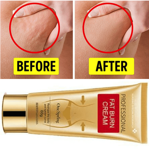 Cellulite Removal Cream For Effective Weight Loss & Slimming