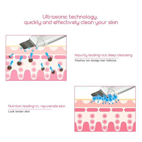 Ultrasonic Skin Scrubber - Worlds #1 Deep Cleaning Machine