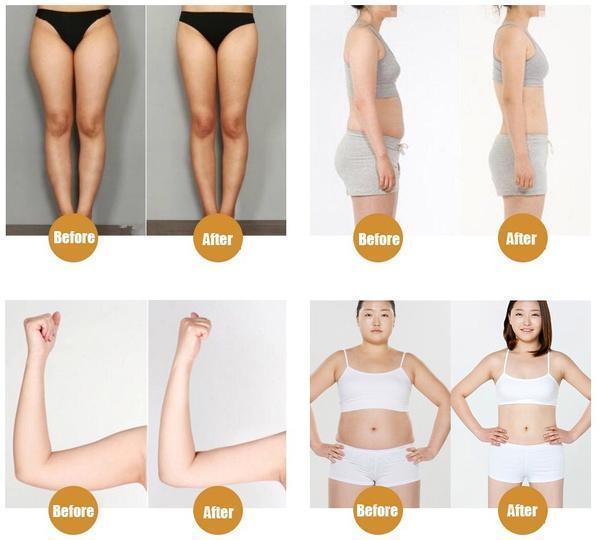 Cellulite Removal Cream For Effective Weight Loss & Slimming