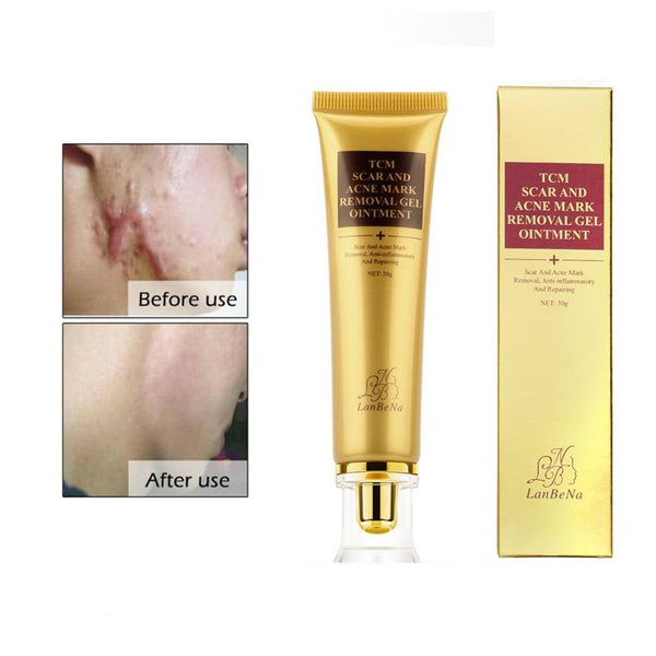 Acne Scar Removal Cream