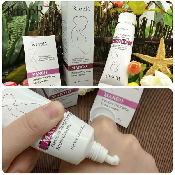 Stretch Mark Removal Cream